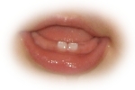 two teeth!