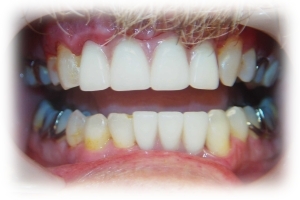 After Image 1