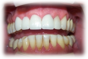 After Image 2