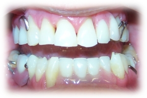 After Image 3