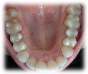 After Image 4