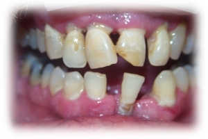 Before Image 1
