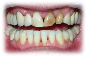 Before Image 2