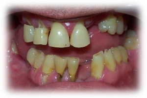 Before Image 3