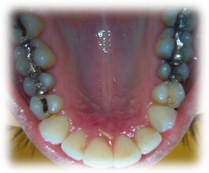 Before Image 4