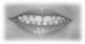 Sealant Smile
